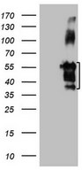 FBLIM1 / Migfilin Antibody - HEK293T cells were transfected with the pCMV6-ENTRY control. (Left lane) or pCMV6-ENTRY FBLIM1. (Right lane) cDNA for 48 hrs and lysed. Equivalent amounts of cell lysates. (5 ug per lane) were separated by SDS-PAGE and immunoblotted with anti-FBLIM1.