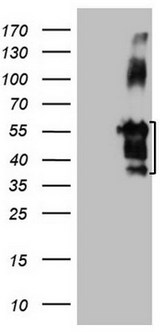 FBLIM1 / Migfilin Antibody - HEK293T cells were transfected with the pCMV6-ENTRY control (Left lane) or pCMV6-ENTRY FBLIM1 (Right lane) cDNA for 48 hrs and lysed. Equivalent amounts of cell lysates (5 ug per lane) were separated by SDS-PAGE and immunoblotted with anti-FBLIM1.