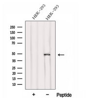 FBLIM1 / Migfilin Antibody - Western blot analysis of extracts of HEK293 cells using FBLIM1 antibody. The lane on the left was treated with blocking peptide.