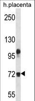 FBLN1 / Fibulin 1 Antibody - FBLN1 Antibody western blot of human placenta tissue lysates (35 ug/lane). The FBLN1 antibody detected the FBLN1 protein (arrow).