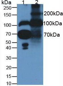 FBLN1 / Fibulin 1 Antibody - Western Blot; Samples. Lane1: Human Serum; Lane2: Rat Placenta Tissue;