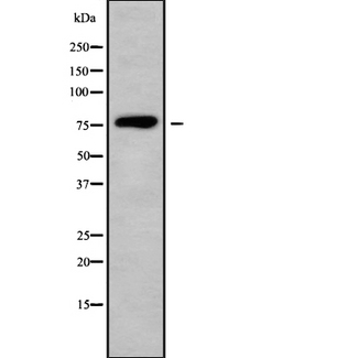 FBLN1 / Fibulin 1 Antibody - Western blot analysis FBLN1 using Jurkat whole cells lysates