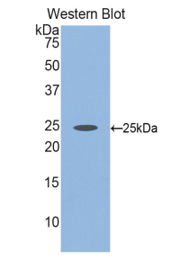 FBLN2 / Fibulin 2 Antibody - Western blot of recombinant FBLN2 / Fibulin 2.  This image was taken for the unconjugated form of this product. Other forms have not been tested.