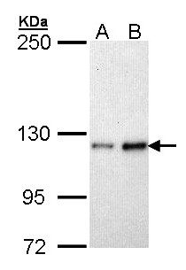 FBLN2 / Fibulin 2 Antibody - Sample (30 ug of whole cell lysate). A: H1299, B: Hela. 5% SDS PAGE. FBLN2 / Fibulin 2 antibody diluted at 1:1000.
