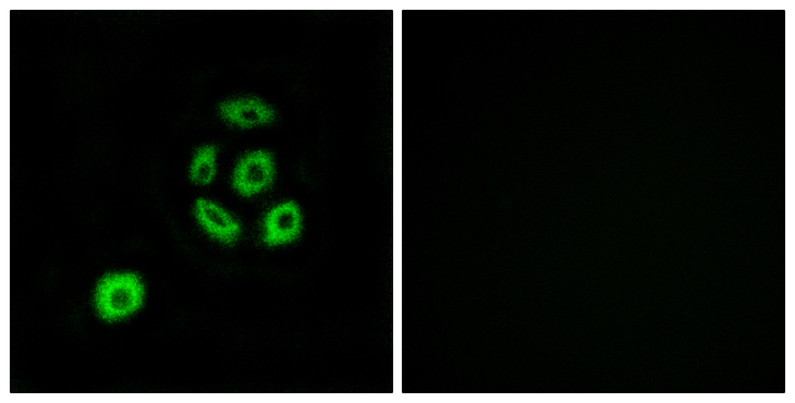 FBLN2 / Fibulin 2 Antibody - Immunofluorescence analysis of A549 cells, using FBLN2 Antibody. The picture on the right is blocked with the synthesized peptide.