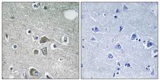 FBLN2 / Fibulin 2 Antibody - Immunohistochemistry analysis of paraffin-embedded human brain tissue, using FBLN2 Antibody. The picture on the right is blocked with the synthesized peptide.
