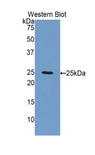 FBLN2 / Fibulin 2 Antibody - Western blot of recombinant FBLN2 / Fibulin 2.  This image was taken for the unconjugated form of this product. Other forms have not been tested.