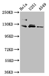 FBLN2 / Fibulin 2 Antibody - Positive Western Blot detected in Hela whole cell lysate, U251 whole cell lysate, A549 whole cell lysate. All lanes: FBLN2 antibody at 3.4 µg/ml Secondary Goat polyclonal to rabbit IgG at 1/50000 dilution. Predicted band size: 127, 132 KDa. Observed band size: 127 KDa