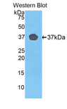 FBLN4 / EFEMP2 Antibody - Western blot of FBLN4 / EFEMP2 antibody.