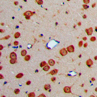 FBLN4 / EFEMP2 Antibody - Immunohistochemical analysis of Fibulin 4 staining in human brain formalin fixed paraffin embedded tissue section. The section was pre-treated using heat mediated antigen retrieval with sodium citrate buffer (pH 6.0). The section was then incubated with the antibody at room temperature and detected using an HRP conjugated compact polymer system. DAB was used as the chromogen. The section was then counterstained with hematoxylin and mounted with DPX.