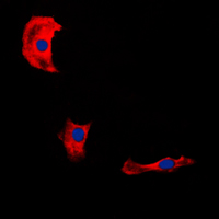 FBLN4 / EFEMP2 Antibody - Immunofluorescent analysis of Fibulin 4 staining in HepG2 cells. Formalin-fixed cells were permeabilized with 0.1% Triton X-100 in TBS for 5-10 minutes and blocked with 3% BSA-PBS for 30 minutes at room temperature. Cells were probed with the primary antibody in 3% BSA-PBS and incubated overnight at 4 C in a humidified chamber. Cells were washed with PBST and incubated with a DyLight 594-conjugated secondary antibody (red) in PBS at room temperature in the dark. DAPI was used to stain the cell nuclei (blue).