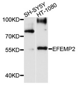 FBLN4 / EFEMP2 Antibody - Western blot analysis of extracts of various cell lines, using EFEMP2 antibody at 1:1000 dilution. The secondary antibody used was an HRP Goat Anti-Rabbit IgG (H+L) at 1:10000 dilution. Lysates were loaded 25ug per lane and 3% nonfat dry milk in TBST was used for blocking. An ECL Kit was used for detection and the exposure time was 90s.