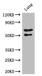 FBLN4 / EFEMP2 Antibody - Positive WB detected in:Mouse lung tissue;All lanes: EFEMP2 antibody at 2.7ug/ml;Secondary;Goat polyclonal to rabbit IgG at 1/50000 dilution;Predicted band size: 50 kDa;Observed band size: 50,70 kDa;