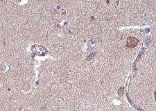 FBLN4 / EFEMP2 Antibody - 1:100 staining human brain tissue by IHC-P. The tissue was formaldehyde fixed and a heat mediated antigen retrieval step in citrate buffer was performed. The tissue was then blocked and incubated with the antibody for 1.5 hours at 22°C. An HRP conjugated goat anti-rabbit antibody was used as the secondary.