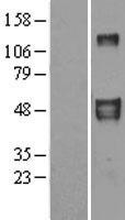 FBLN4 / EFEMP2 Protein - Western validation with an anti-DDK antibody * L: Control HEK293 lysate R: Over-expression lysate