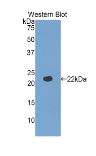 FBLN5 / Fibulin 5 Antibody - Western blot of recombinant FBLN5 / Fibulin 5.  This image was taken for the unconjugated form of this product. Other forms have not been tested.