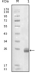 FBLN5 / Fibulin 5 Antibody - Western blot using FBLN5 mouse monoclonal antibody against truncated FBLN5-His recombinant protein.