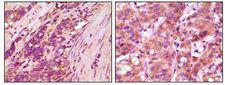 FBLN5 / Fibulin 5 Antibody - Fibulin 5 Antibody in Immunohistochemistry (IHC)