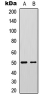 FBLN5 / Fibulin 5 Antibody - Western blot analysis of Fibulin 5 expression in A431 (A); NIH3T3 (B) whole cell lysates.