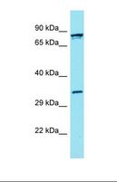 FBLN7 / Fibulin 7 Antibody - Western blot of Human OVCAR-3. FBLN7 antibody dilution 1.0 ug/ml.  This image was taken for the unconjugated form of this product. Other forms have not been tested.
