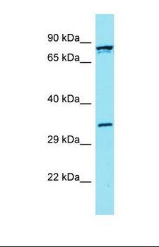 FBLN7 / Fibulin 7 Antibody - Western blot of Human OVCAR-3. FBLN7 antibody dilution 1.0 ug/ml.  This image was taken for the unconjugated form of this product. Other forms have not been tested.