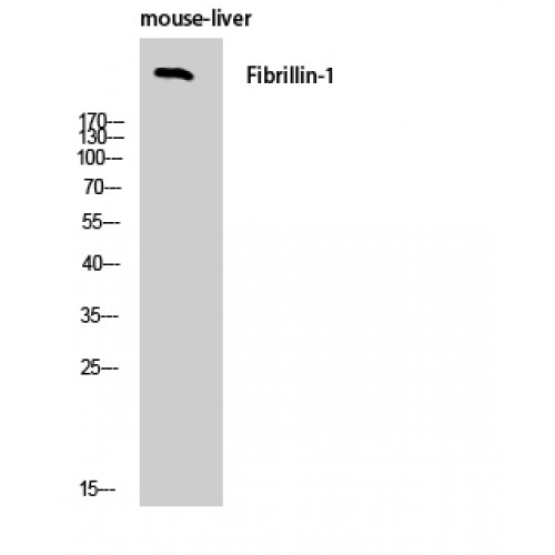 FBN1 / Fibrillin 1 Antibody - Western blot of FBN1 antibody