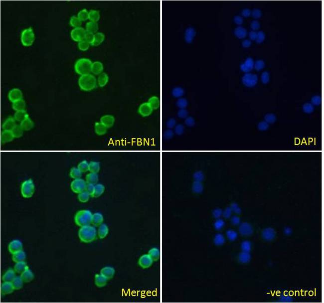 FBN1 / Fibrillin 1 Antibody - FBN1 / Fibrillin 1 antibody immunofluorescence analysis of paraformaldehyde fixed Jurkat cells, permeabilized with 0.15% Triton. Primary incubation 1hr (10ug/ml) followed by Alexa Fluor 488 secondary antibody (4ug/ml), showing cytoplasmic staining. The nuclear stain is DAPI (blue). Negative control: Unimmunized goat IgG (10ug/ml) followed by Alexa Fluor 488 secondary antibody (2ug/ml).