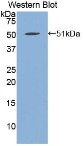 FBN1 / Fibrillin 1 Antibody - Western blot of FBN1 / Fibrillin 1 antibody.