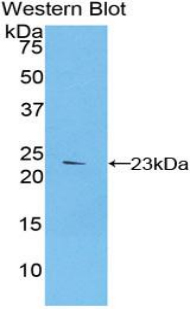 FBN1 / Fibrillin 1 Antibody - Western blot of recombinant FBN1 / Fibrillin 1.  This image was taken for the unconjugated form of this product. Other forms have not been tested.