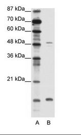FBN1 / Fibrillin 1 Antibody - A: Marker, B: Jurkat Cell Lysate.  This image was taken for the unconjugated form of this product. Other forms have not been tested.