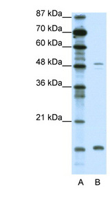 FBN1 / Fibrillin 1 Antibody - FBN1 / Fibrillin 1 antibody Western blot of Jurkat lysate. This image was taken for the unconjugated form of this product. Other forms have not been tested.