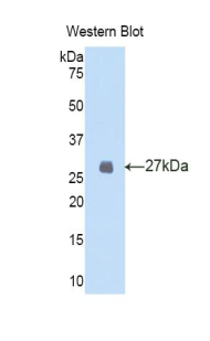 FBN2 / Fibrillin 2 Antibody - Western blot of recombinant FBN2 / Fibrillin 2.  This image was taken for the unconjugated form of this product. Other forms have not been tested.