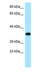 FBP / FOLR2 Antibody - FBP / FOLR2 antibody Western Blot of MCF7.  This image was taken for the unconjugated form of this product. Other forms have not been tested.