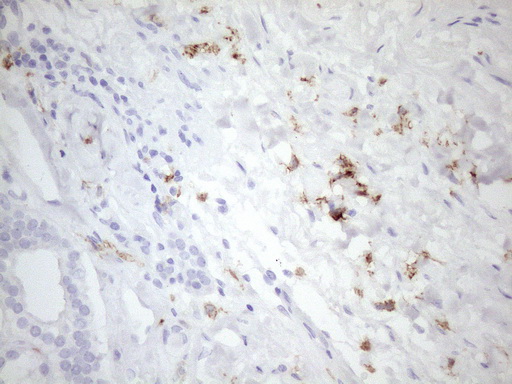 FBP / FOLR2 Antibody - Immunohistochemical staining of paraffin-embedded Human Kidney tissue within the normal limits using anti-FOLR2 mouse monoclonal antibody. (Heat-induced epitope retrieval by 1mM EDTA in 10mM Tris buffer. (pH8.5) at 120 oC for 3 min. (1:150)