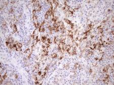 FBP / FOLR2 Antibody - Immunohistochemical staining of paraffin-embedded Human lymph node tissue within the normal limits using anti-FOLR2 mouse monoclonal antibody. (Heat-induced epitope retrieval by 1mM EDTA in 10mM Tris buffer. (pH8.5) at 120°C for 3 min. (1:150)