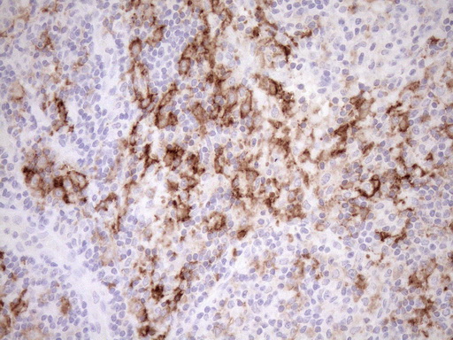 FBP / FOLR2 Antibody - Immunohistochemical staining of paraffin-embedded Human lymph node tissue within the normal limits using anti-FOLR2 mouse monoclonal antibody. (Heat-induced epitope retrieval by 1mM EDTA in 10mM Tris buffer. (pH8.5) at 120°C for 3 min. (1:150)