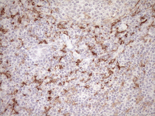 FBP / FOLR2 Antibody - Immunohistochemical staining of paraffin-embedded Human tonsil within the normal limits using anti-FOLR2 mouse monoclonal antibody. (Heat-induced epitope retrieval by 1mM EDTA in 10mM Tris buffer. (pH8.5) at 120°C for 3 min. (1:150)