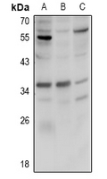 FBP / FOLR2 Antibody - Western blot analysis of FR beta expression in HCT116 (A), CT26 (B), PC12 (C) whole cell lysates.