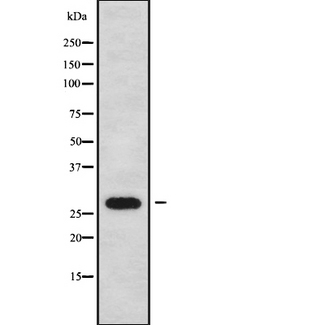 FBP / FOLR2 Antibody - Western blot analysis FOLR2 using HeLa whole cells lysates