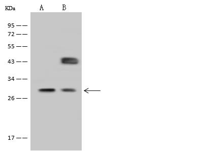 FBP / FOLR2 Antibody - Anti-FOLR2 rabbit polyclonal antibody at 1:500 dilution. Lane A: HeLa Whole Cell Lysate. Lane B: MCF-7 Whole Cell Lysate. Lysates/proteins at 30 ug per lane. Secondary: Goat Anti-Rabbit IgG (H+L)/HRP at 1/10000 dilution. Developed using the ECL technique. Performed under reducing conditions. Predicted band size: 29 kDa. Observed band size: 29 kDa. (We are unsure as to the identity of these extra bands.)