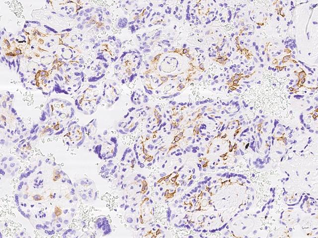 FBP / FOLR2 Antibody - Immunochemical staining of human FOLR2 in human placenta with rabbit polyclonal antibody at 1:1000 dilution, formalin-fixed paraffin embedded sections.