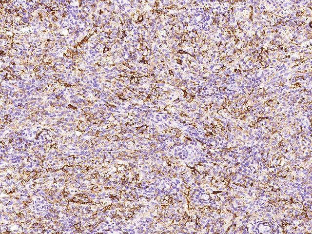 FBP / FOLR2 Antibody - Immunochemical staining of human FOLR2 in human spleen with rabbit polyclonal antibody at 1:1000 dilution, formalin-fixed paraffin embedded sections.