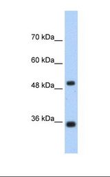FBP1 Antibody - Jurkat cell lysate. Antibody concentration: 1.25 ug/ml. Gel concentration: 12%.  This image was taken for the unconjugated form of this product. Other forms have not been tested.