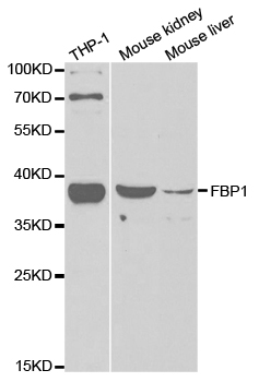 FBP1 Antibody - Western blot analysis of extracts of various cell lines.