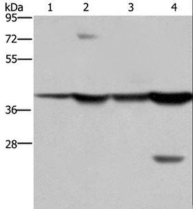 FBP1 Antibody - Western blot analysis of Mouse stomach and human fetal liver tissue, MCF-7 cell and mouse liver tissue, using FBP1 Polyclonal Antibody at dilution of 1:850.