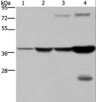FBP1 Antibody - Western blot analysis of Mouse stomach and human fetal liver tissue, MCF-7 cell and mouse liver tissue, using FBP1 Polyclonal Antibody at dilution of 1:550.