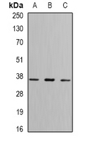 FBP1 Antibody - Western blot analysis of FBP1 expression in THP1 (A); mouse kidney (B); mouse liver (C) whole cell lysates.