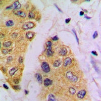 FBP1 Antibody - Immunohistochemical analysis of FBP1 staining in mouse pancreas formalin fixed paraffin embedded tissue section. The section was pre-treated using heat mediated antigen retrieval with sodium citrate buffer (pH 6.0). The section was then incubated with the antibody at room temperature and detected using an HRP conjugated compact polymer system. DAB was used as the chromogen. The section was then counterstained with hematoxylin and mounted with DPX.