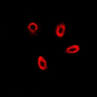 FBP1 Antibody - Immunofluorescent analysis of FBP1 staining in MCF7 cells. Formalin-fixed cells were permeabilized with 0.1% Triton X-100 in TBS for 5-10 minutes and blocked with 3% BSA-PBS for 30 minutes at room temperature. Cells were probed with the primary antibody in 3% BSA-PBS and incubated overnight at 4 deg C in a humidified chamber. Cells were washed with PBST and incubated with a DyLight 594-conjugated secondary antibody (red) in PBS at room temperature in the dark.