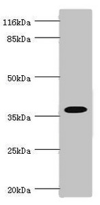 FBP1 Antibody - Western blot All Lanes:FBP1 antibody at 3.06ug/ml Lane 1:mouse liver tissue Lane 2:mouse kidney tissue Secondary Goat polyclonal to rabbit at 1/10000 dilution Predicted band size: 37kDa Observed band size: 37kDa